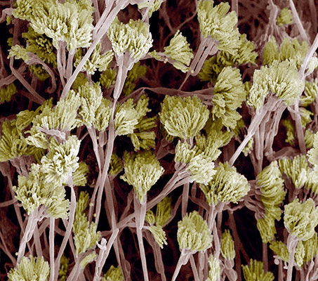 Micrographie électronique à balayage couleur de penicillium fungus.  © Steve Gschmeissner/ SPL/ Cosmos